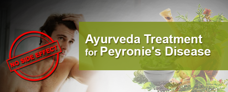 Ayurveda Treatment for Peyronie's Disease 