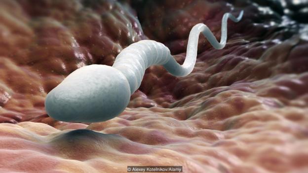 Low Sperm Count – A Succint Study into its Causes