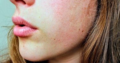 Six natural home remedies to treat itchy and dry skin