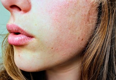 Six natural home remedies to treat itchy and dry skin