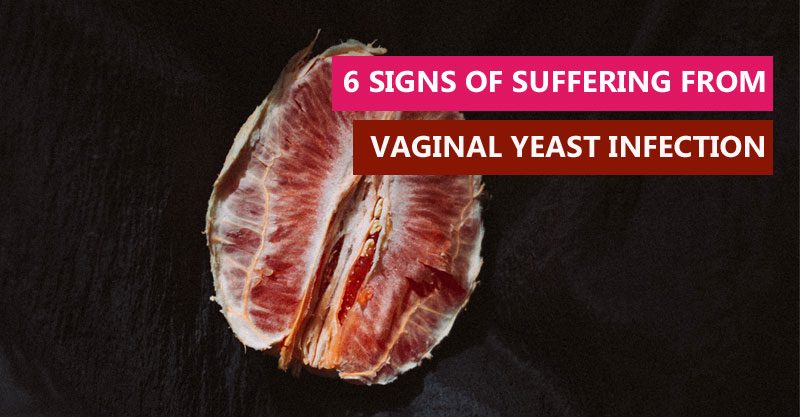 6 signs of suffering from vaginal yeast infection