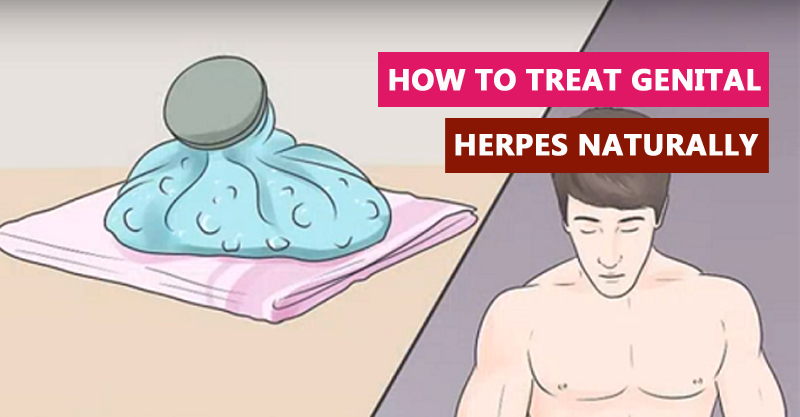 How to Treat Genital Herpes Naturally