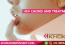 HSV Causes and Treatment