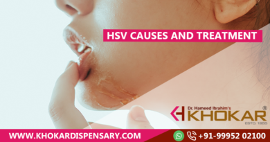 HSV Causes and Treatment