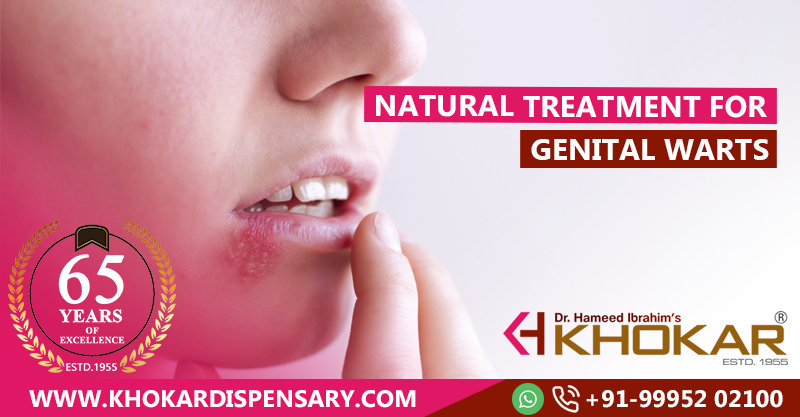 Natural Treatment for Genital Warts