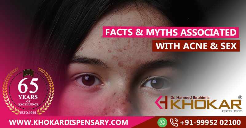 Facts & Myths associated with Acne & Sex