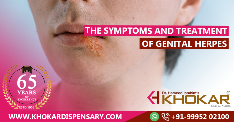 The symptoms and Treatment of Genital Herpes