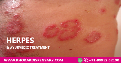 Herpes & Ayurvedic Treatment