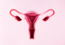 Can cervical stenosis cause infertility? Can cervical stenosis cause infertility