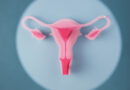 <strong>Polycystic Ovarian Syndrome</strong> Polycystic Ovarian Syndrome